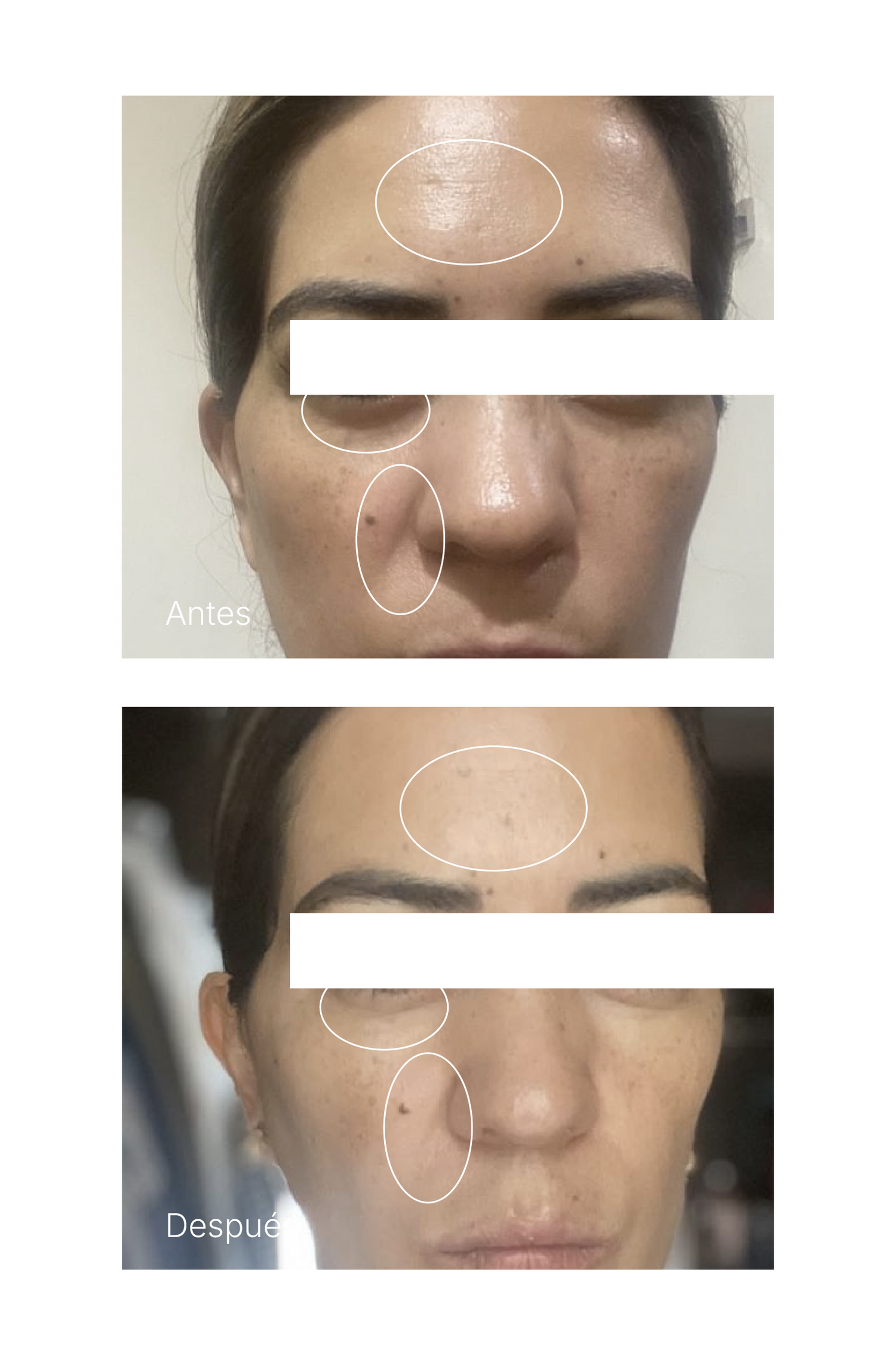 TIMELESS GLOW KIT