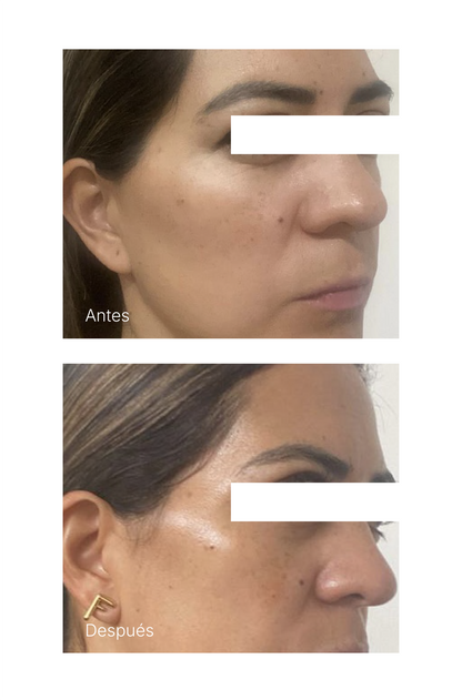 TIMELESS GLOW KIT